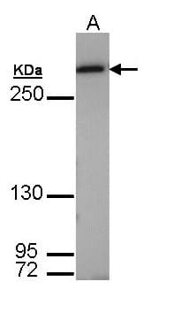 FASN / Fatty Acid Synthase Antibody (aa7-287)