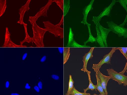 EGFR Antibody (clone UMAB95)