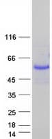 Human USP27X Protein (Recombinant Myc-DDK (Flag))