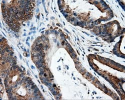 IFT57 / HIPPI Antibody (clone OTI4F6)