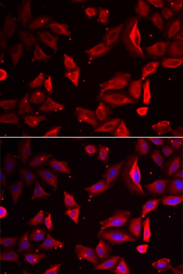 SERPINB9 / PI9 Antibody
