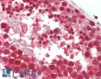 IHC-plus™ RENT1 / UPF1 Antibody (aa1079-1129)