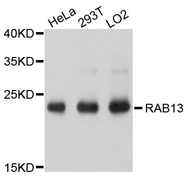 Polyclonal Rabbit anti-Human RAB13 Antibody (WB)