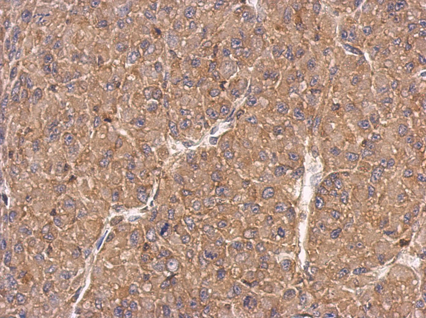 FMNL1 Antibody (aa631-903)