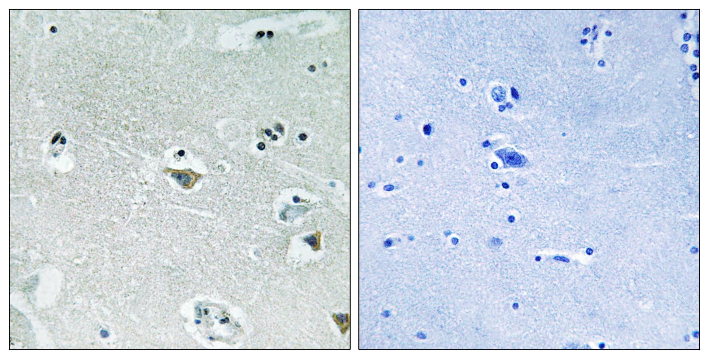 Polyclonal Rabbit anti-Human SREBF1 / SREBP-1 Antibody (phospho-Ser439, IHC, WB)