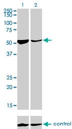 IHC-plus™ Monoclonal Mouse anti-Human DARS Antibody (clone 2F11, IHC, WB)