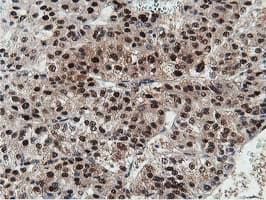 Dipeptidyl Peptidase 3 / DPP3 Antibody (clone OTI2D9)