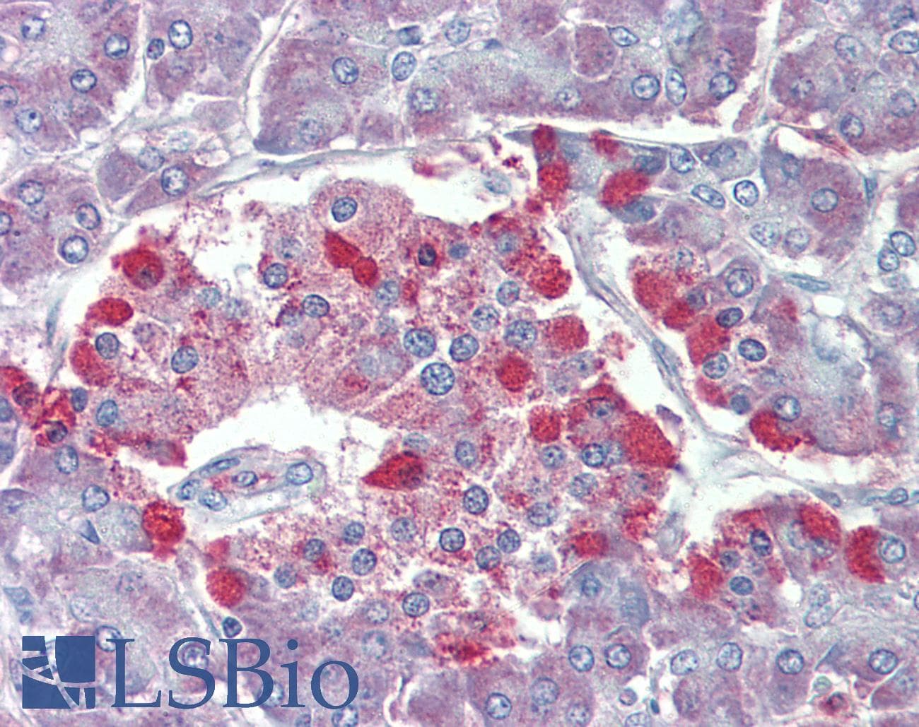 IHC-plus™ TRPM2 Antibody (aa1139-1150)