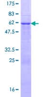 Human LAT2 / NTAL Protein (Recombinant GST)