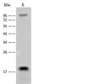Polyclonal Rabbit anti-Human NAA50 / NAT13 / SAN Antibody (WB)