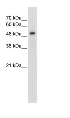 SLC1A5 / ASCT2 Antibody (aa241-290)