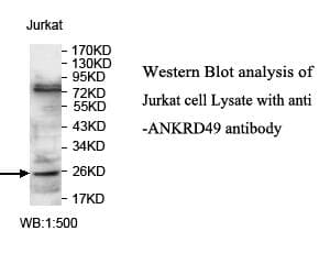 Polyclonal Rabbit anti-Human ANKRD49 Antibody (aa2-239, IHC, WB)