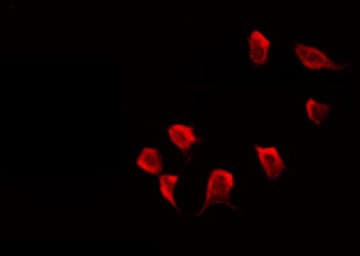 GABRG1 Antibody