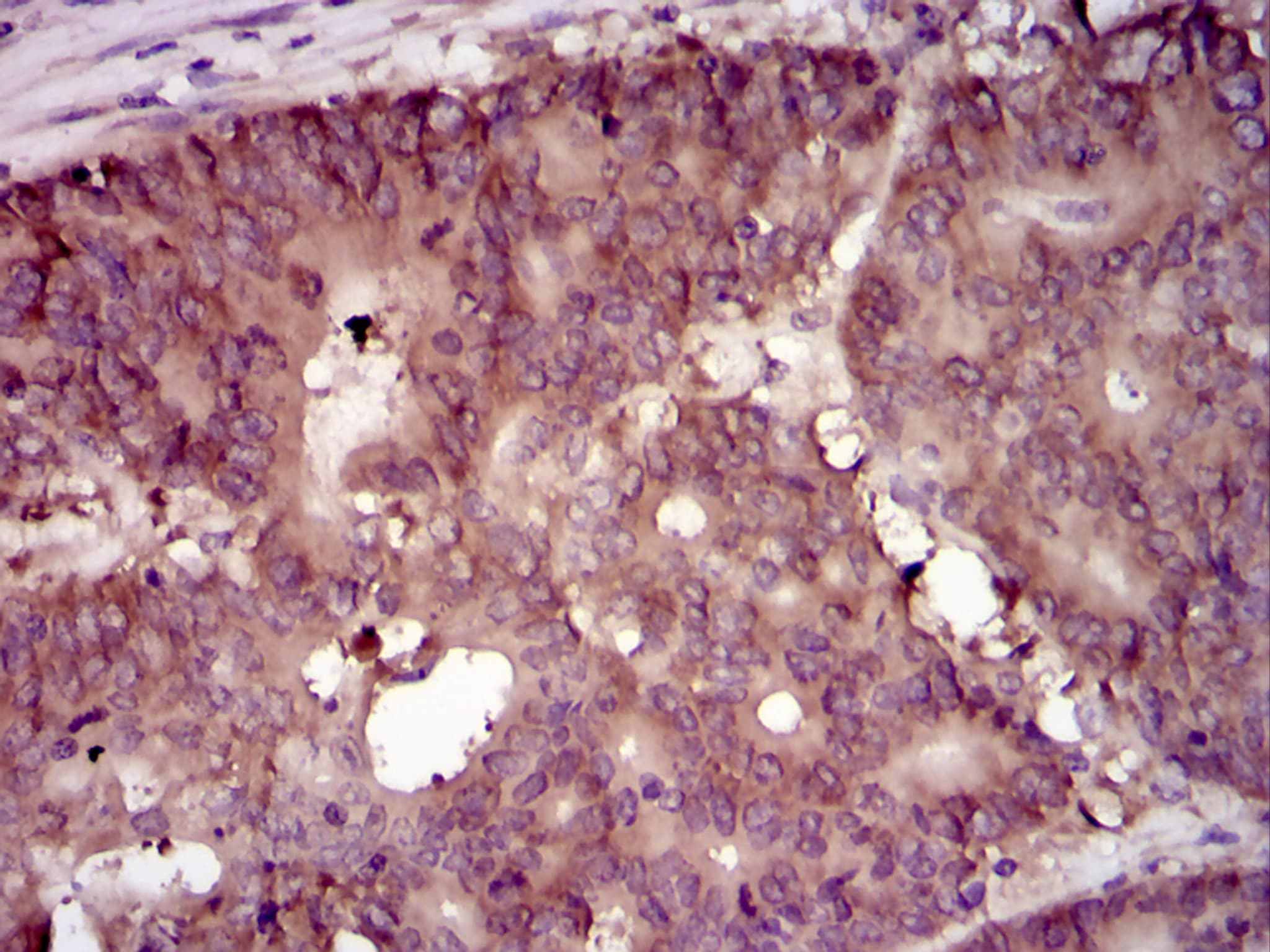 EIF4B Antibody (clone 1F5)