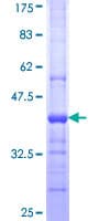 Human PLA2G15 / ACS Protein (Recombinant GST, N-terminus)