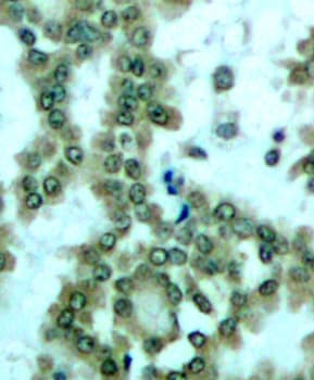PRKCQ / PKC-Theta Antibody (phospho-Ser676)