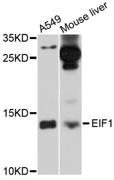 Polyclonal Rabbit anti-Human EIF1 Antibody (WB)