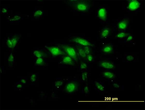 CAPG Antibody (clone 1F1)