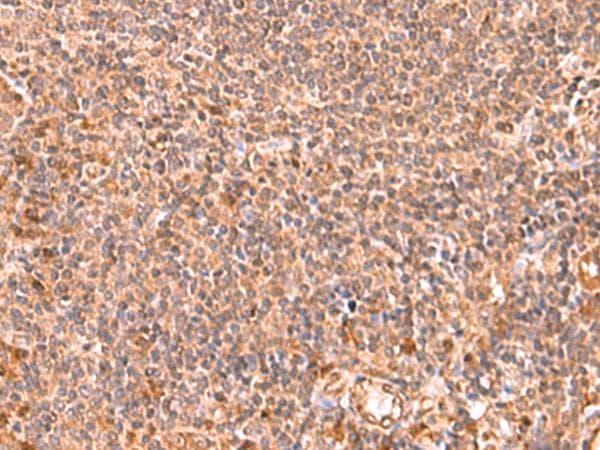 RABEPK / p40 Antibody