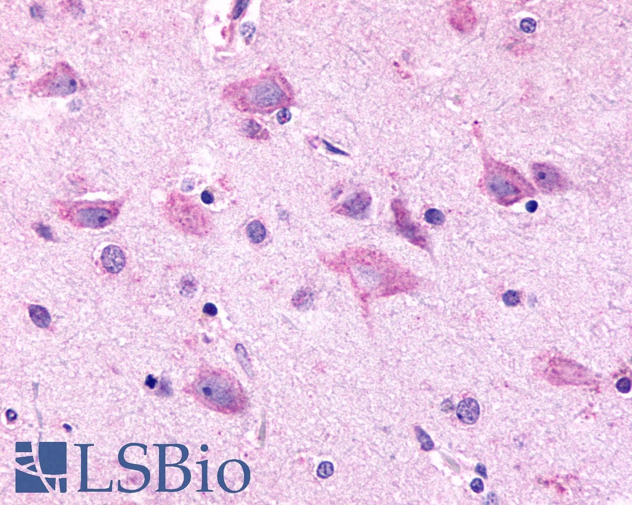 IHC-plus™ Polyclonal Rabbit anti-Human ADGRV1 / GPR98 Antibody (N-Terminus, IHC, WB)