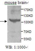 IHC-plus™ Polyclonal Rabbit anti-Human TNK2 / ACK1 Antibody (aa278-289, IHC, WB)