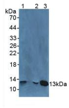 B2M / Beta 2 Microglobulin Antibody (aa22-119)