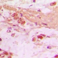 TSC22D1 / TSC22 Antibody (C-Terminus)