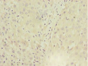 MGAT / GLYT1 Antibody