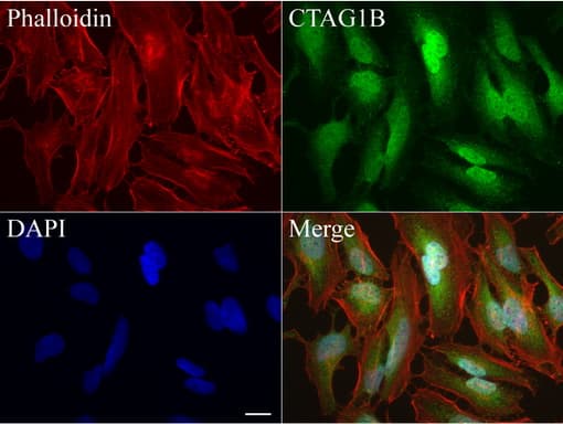 CTAG1B / NY-ESO-1 Antibody (clone UMAB73)