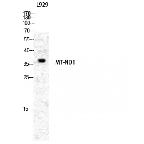 Polyclonal Rabbit anti-Human MT-ND1 Antibody (150-230 aa, Internal, IHC, WB)