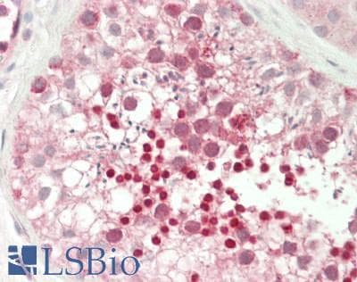 IHC-plus™ Polyclonal Rabbit anti-Human CREM / ICER Antibody (IHC, WB)