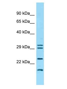 Polyclonal Rabbit anti-Human IFNK Antibody (aa147-196, WB)