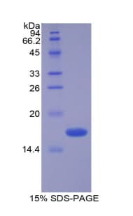 Mouse VIP Protein (Recombinant His)