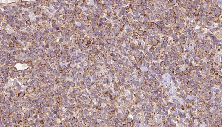 URAT1 / SLC22A12 Antibody