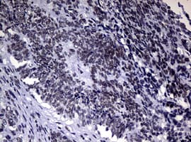 NBN / Nibrin Antibody (aa183-460, clone OTI3C12, Carrier-free)