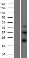 S100A4 / FSP1 Protein (Over-Expression Lysate Myc-DDK (Flag))
