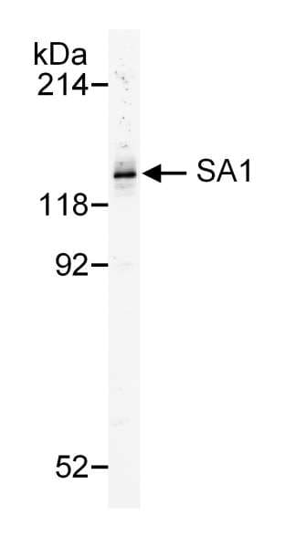 STAG1 / SA1 Antibody (aa1150-1200)