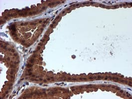 HARS2 Antibody (clone OTI5H2)
