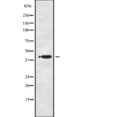 P2RY1 / P2Y1 Antibody