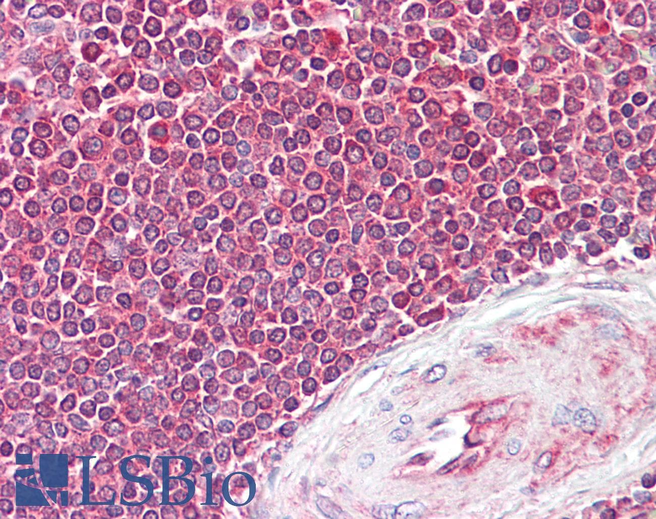 IHC-plus™ EIF4B Antibody (aa150-200)