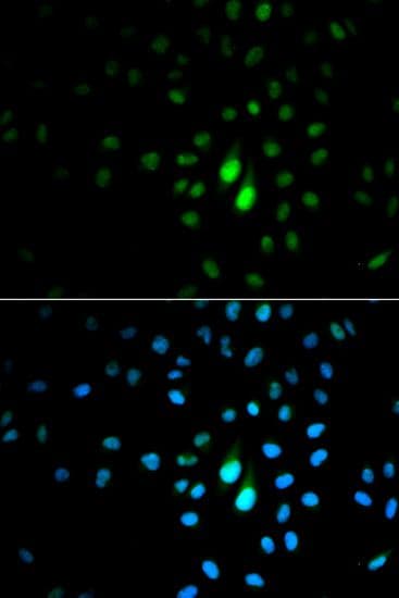 Polyclonal Rabbit anti-Human PIN1 Antibody (IF, WB)
