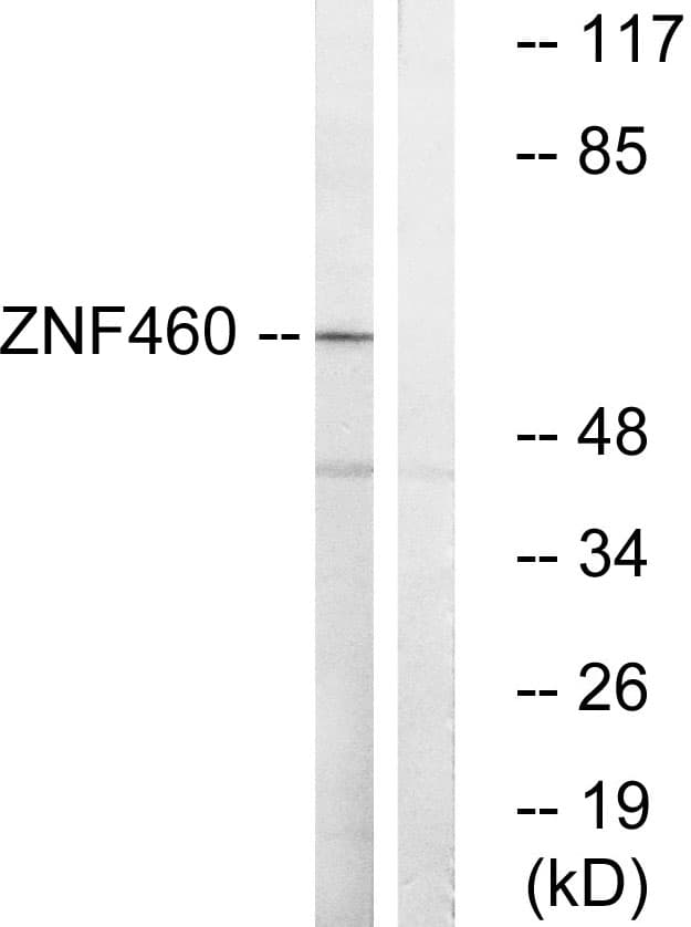 ZNF460 Antibody (aa461-510)