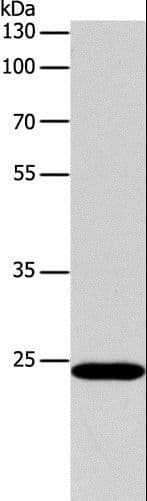 BCL2 / Bcl-2 Antibody