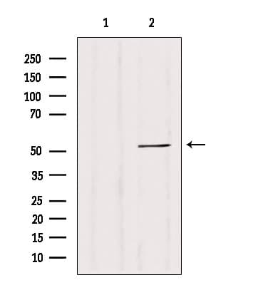 Polyclonal Rabbit anti-Human CALCOCO2 Antibody (IHC, IF, WB)