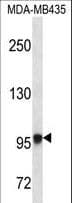 Polyclonal Rabbit anti-Human EXTL3 Antibody (aa345-374, IHC, WB)