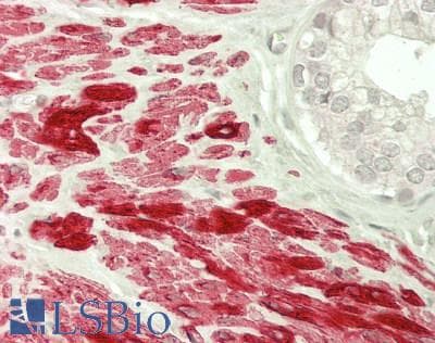 IHC-plus™ DES / Desmin Antibody (clone D33)