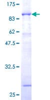 Human NCF2 / NOXA2 / p67phox Protein (Recombinant GST)