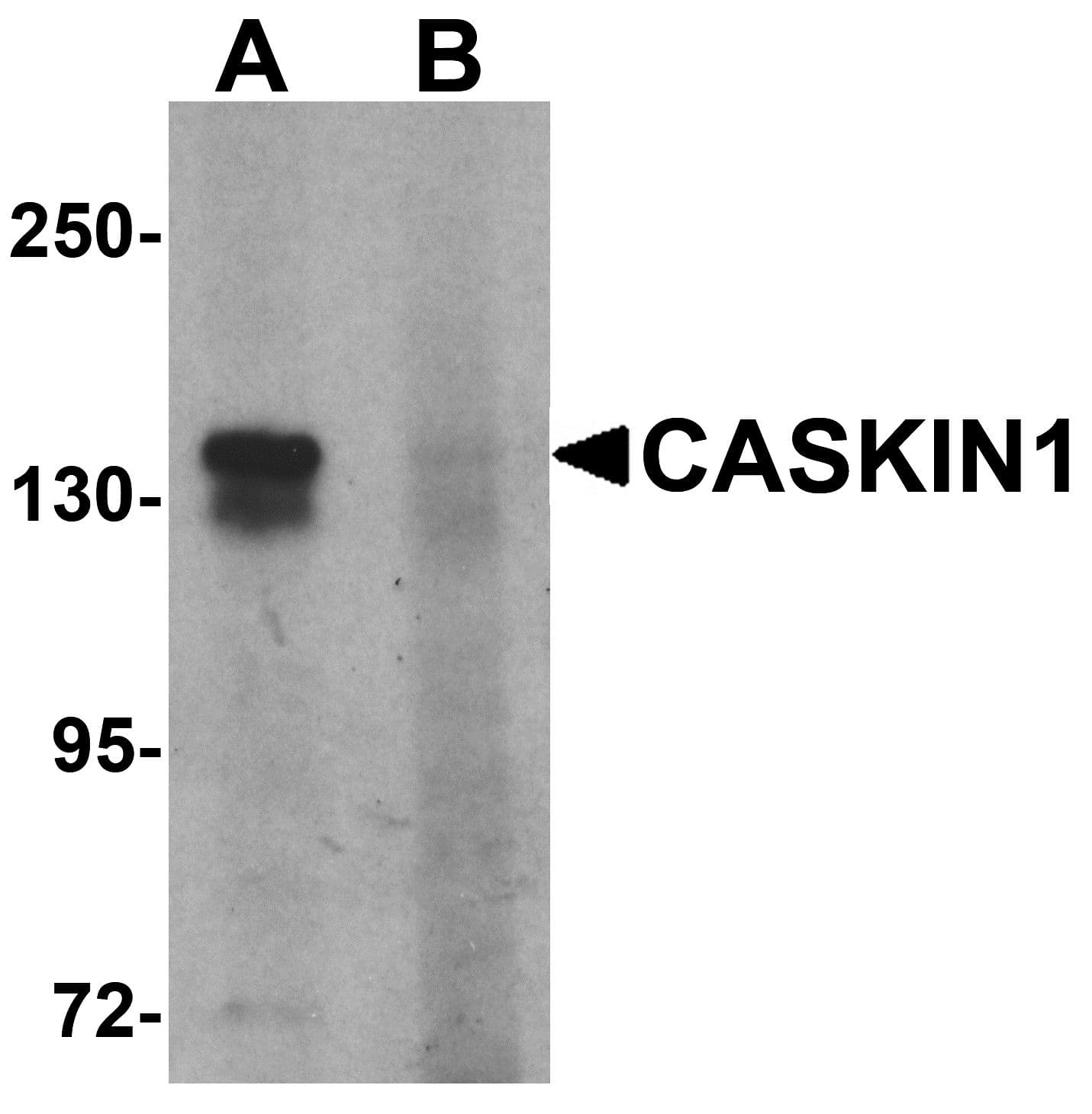 IHC-plus™ CASKIN1 Antibody