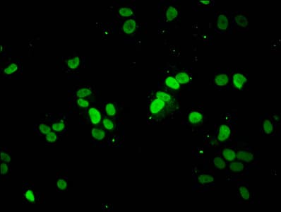 HIST1H1E Antibody
