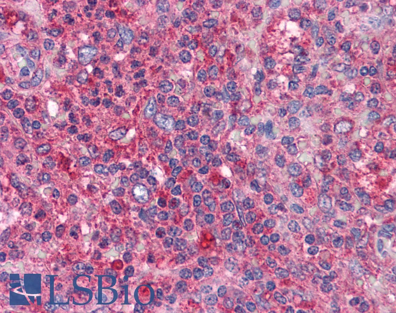 IHC-plus™ BIRC3 / cIAP2 Antibody